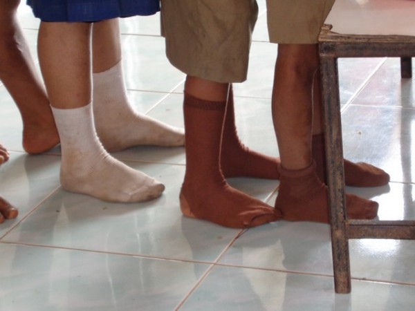 The sock problem was not as prevalent today, but a lot were simply not wearing socks.
